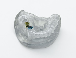 MANIFATTURA ADDITIVA DENTALE REGGIO